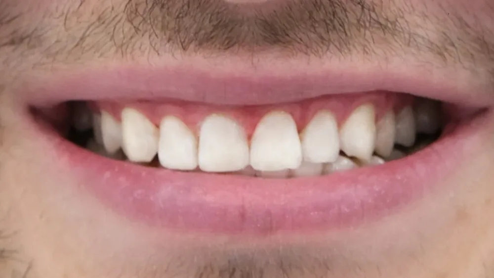 Smile before treatment